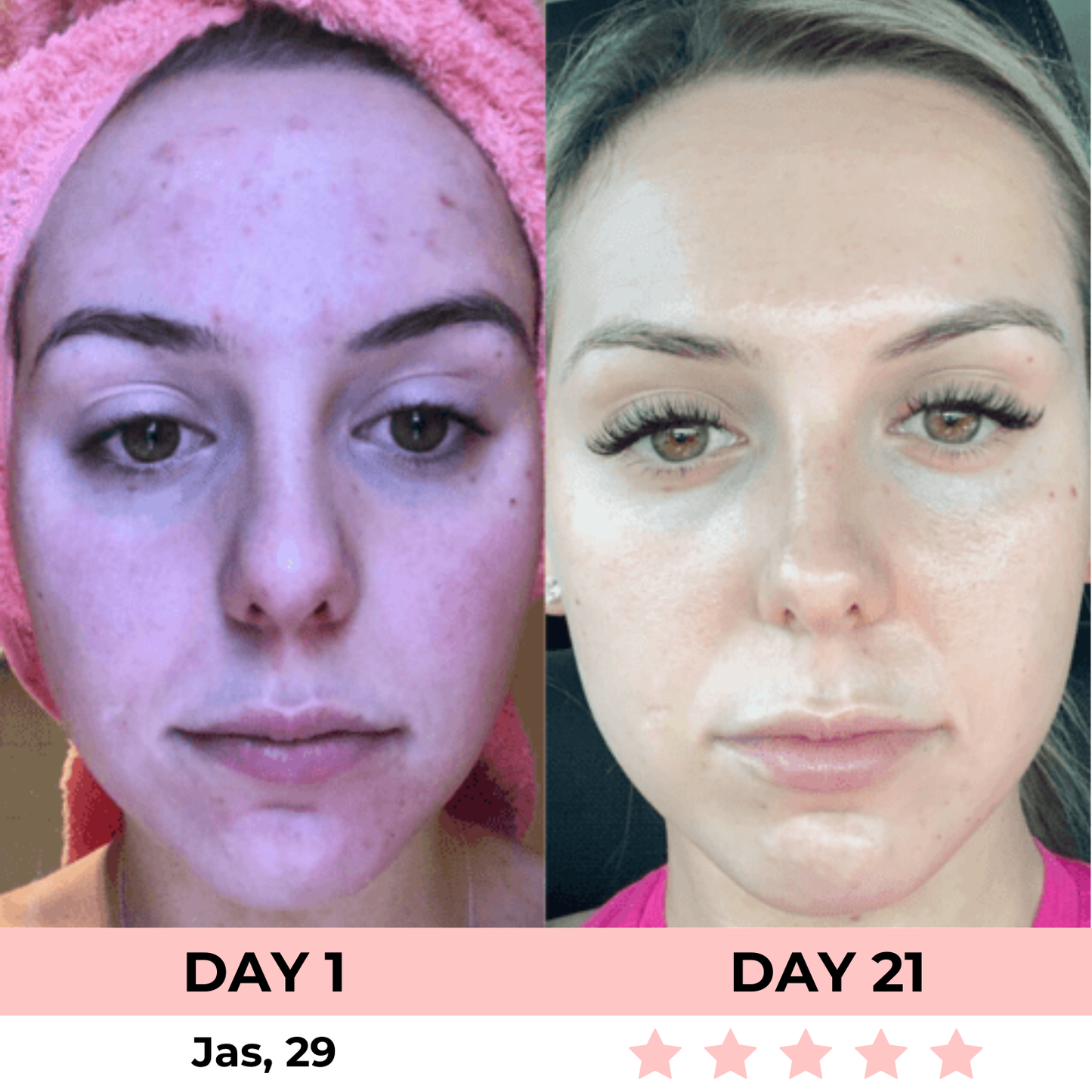 LuxGlow Skin Pro – 7-in-1 LED Anti-Aging Facial Sculptor