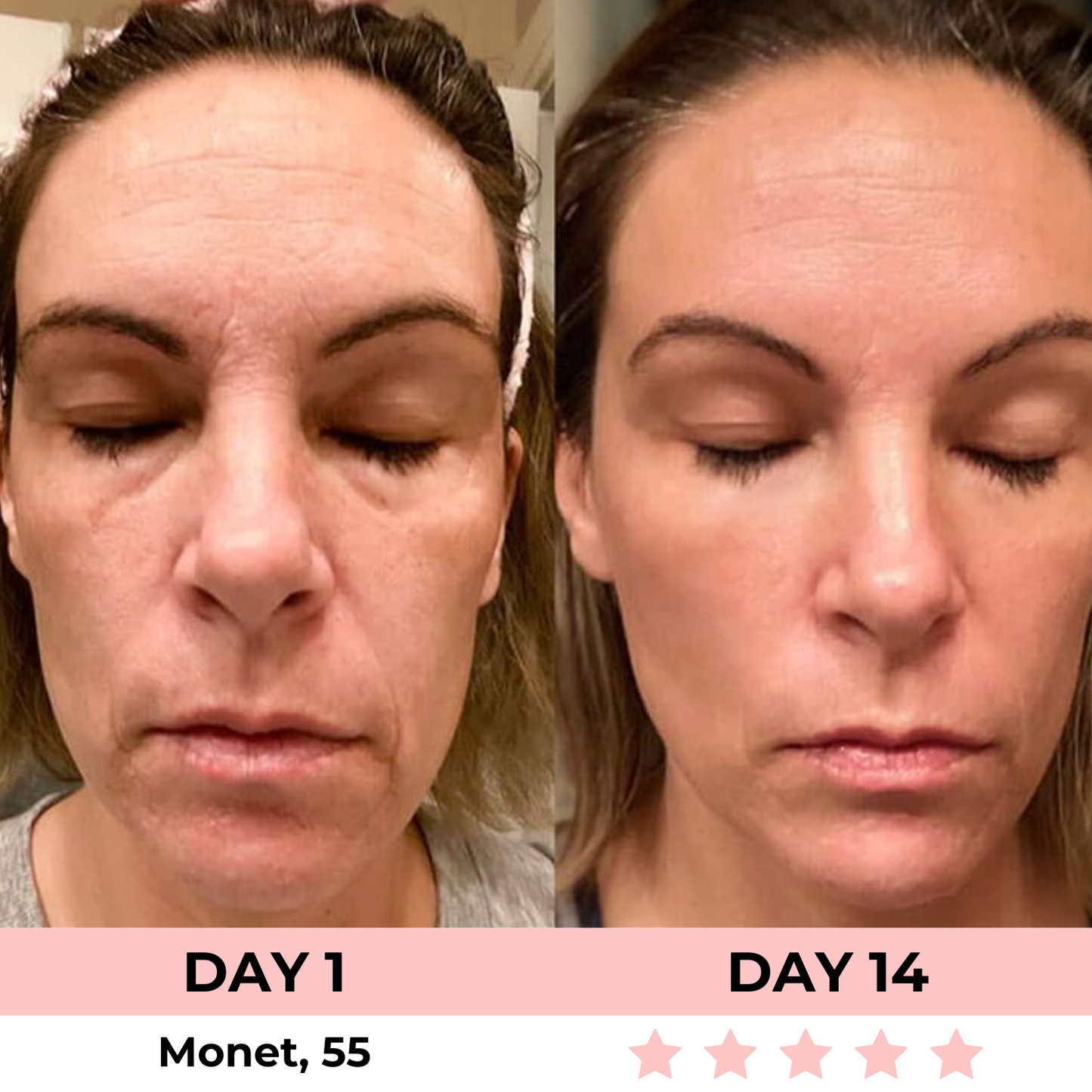 LuxGlow Skin Pro – 7-in-1 LED Anti-Aging Facial Sculptor