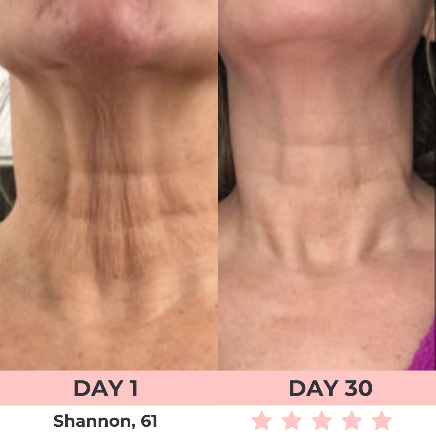 LuxGlow Skin Pro – 7-in-1 LED Anti-Aging Facial Sculptor