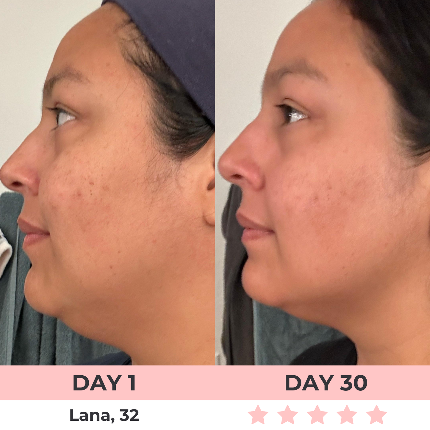 LuxGlow Skin Pro – 7-in-1 LED Anti-Aging Facial Sculptor