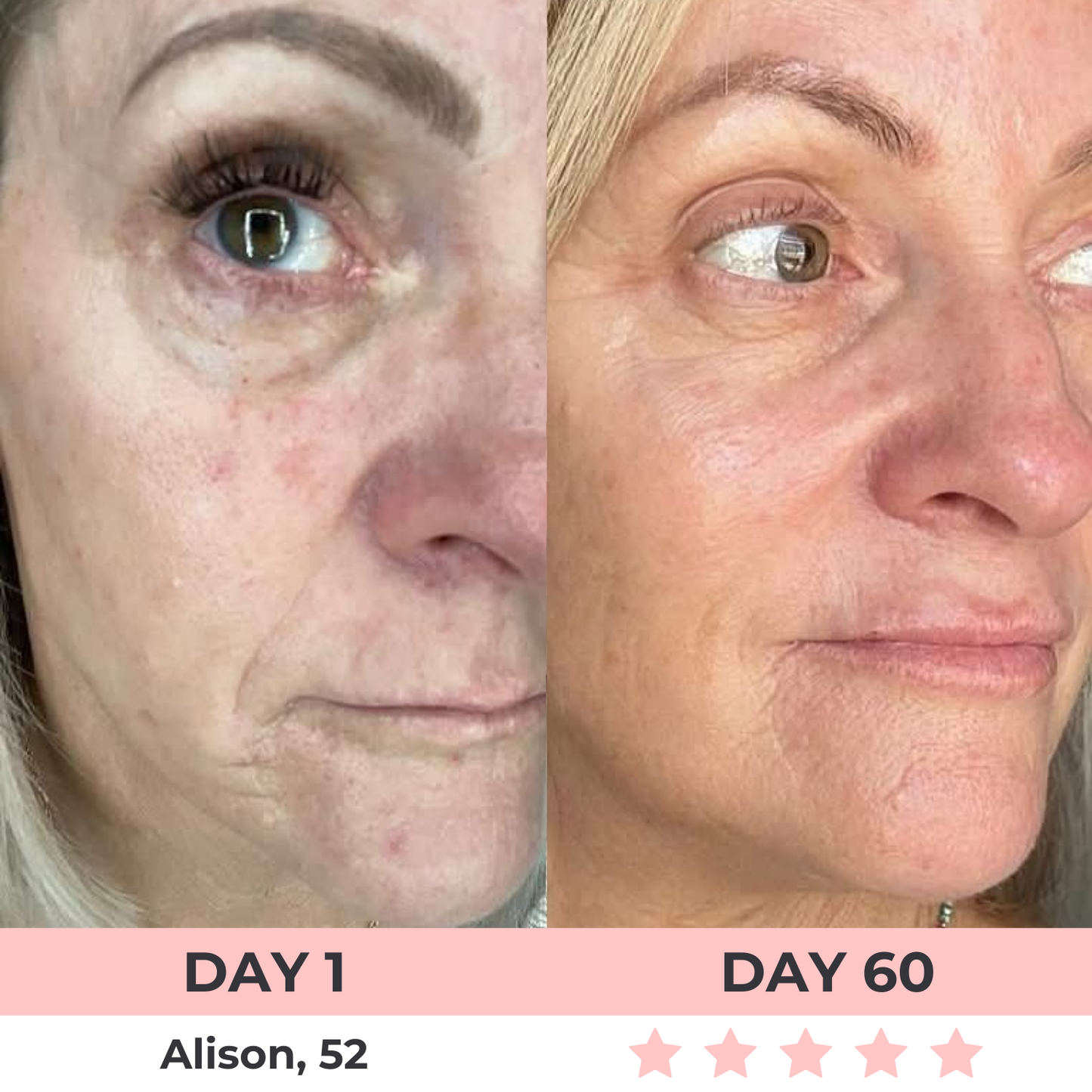 LuxGlow Skin Pro – 7-in-1 LED Anti-Aging Facial Sculptor