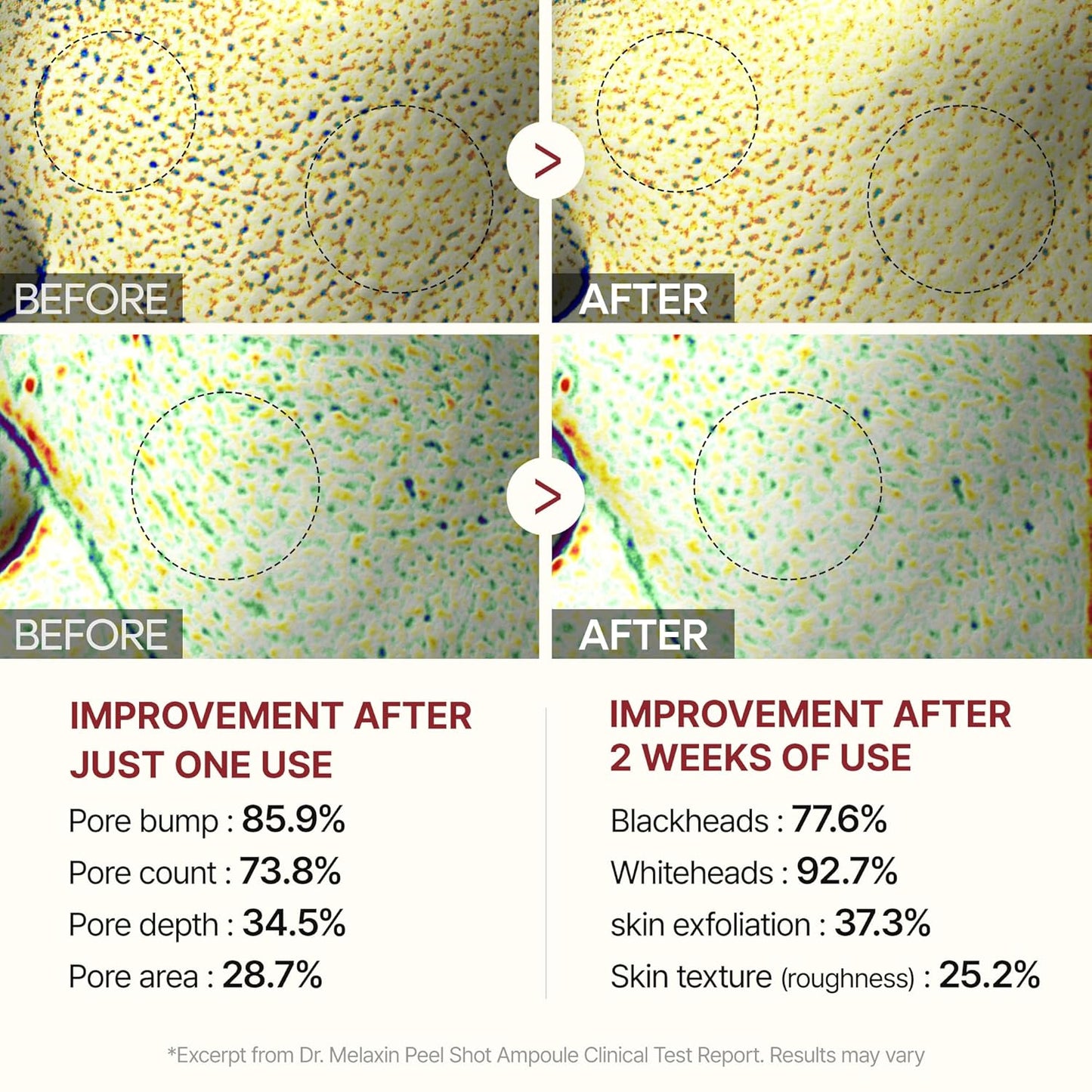 Glow Rice Peel Ampoule-Soft Rice Peeling Scrub