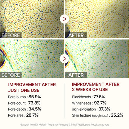 Glow Rice Peel Ampoule-Soft Rice Peeling Scrub